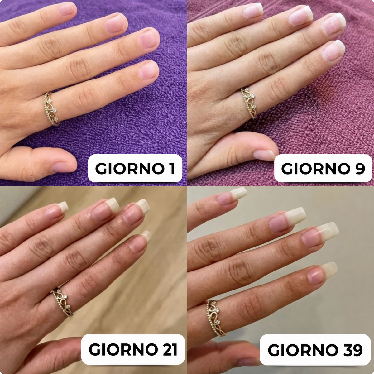 Siero crescita unghie Glowria™